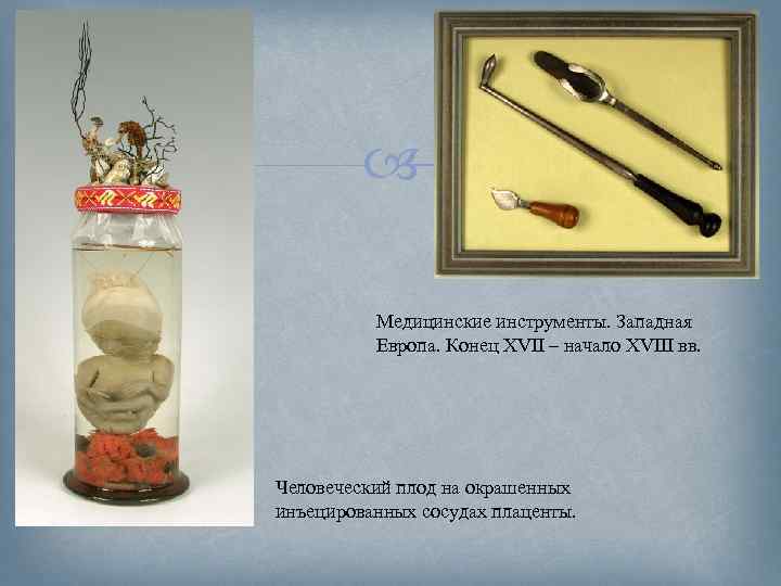  Медицинские инструменты. Западная Европа. Конец XVII – начало XVIII вв. Человеческий плод на