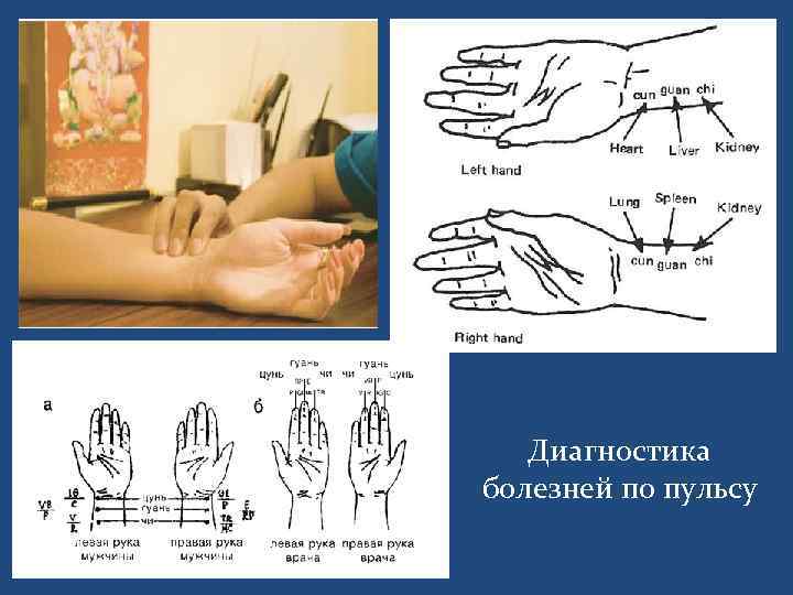 Диагностика болезней по пульсу 