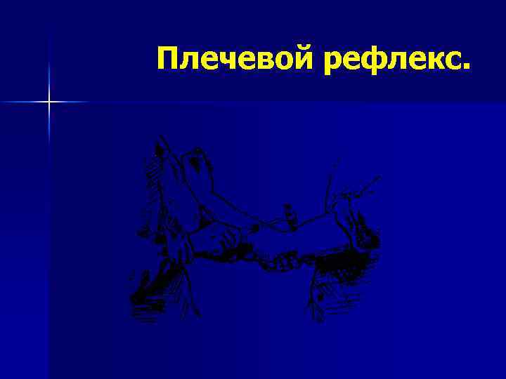 Плечевой рефлекс. 