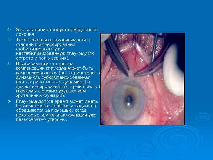 Это состояние требует немедленного лечения. Ø Также выделяют в зависимости от степени прогрессирования стабилизированную