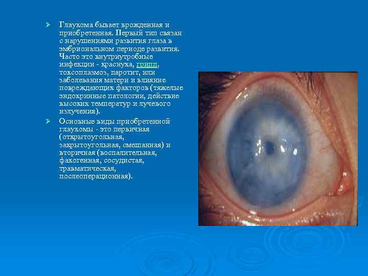 Глаукома бывает врожденная и приобретенная. Первый тип связан с нарушениями развития глаза в эмбриональном