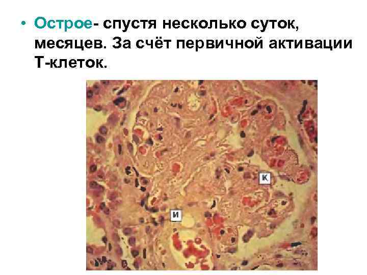  • Острое- спустя несколько суток, месяцев. За счёт первичной активации Т-клеток. 