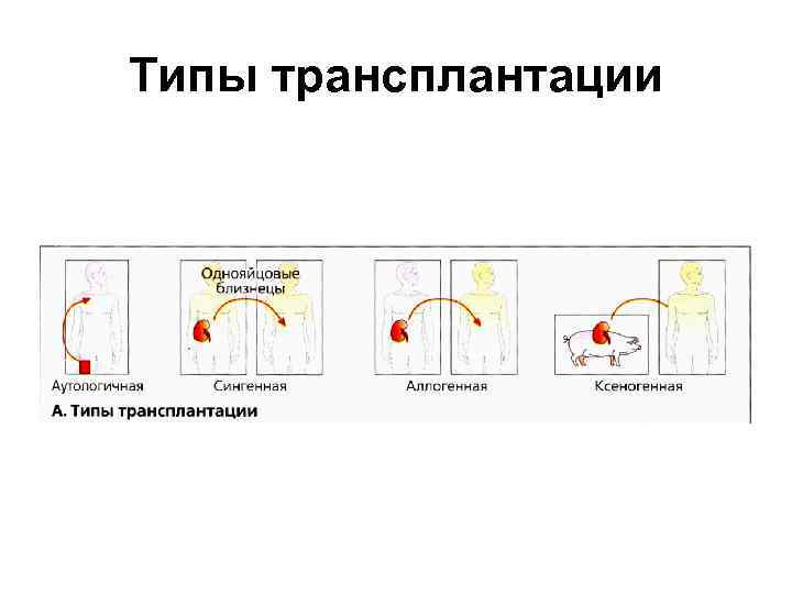 Типы трансплантации 