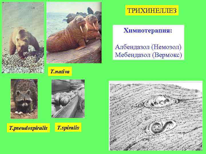 ТРИХИНЕЛЛЕЗ Химиотерапия: Албендазол (Немозол) Мебендазол (Вермокс) T. nativa T. pseudospiralis T. spiralis 