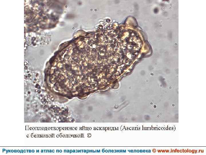 Яйца аскарид. Яйца аскариды под микроскопом. Яйцо аскариды неоплодотворенное с белковой оболочкой. Яйцо аскариды неоплодотворенное в Кале.