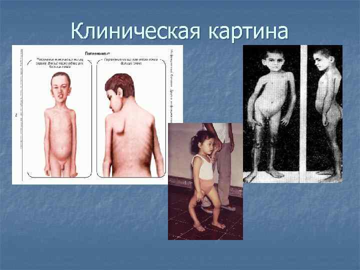 Клиническая картина 