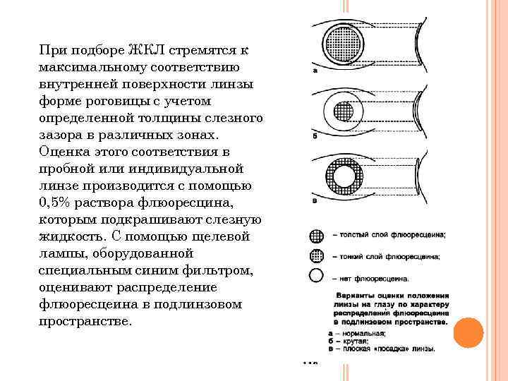 Внутреннее соответствие. Методика подбора контактных линз. Диаметр жёсткой контактной линзы. Задачи по расчету жестких контактных линз.