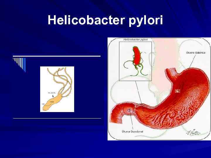 Хеликобактер пилори рисунок