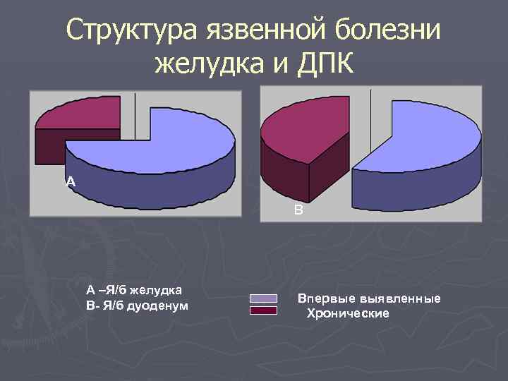 Структура язвенной болезни желудка и ДПК А В А –Я/б желудка В- Я/б дуоденум