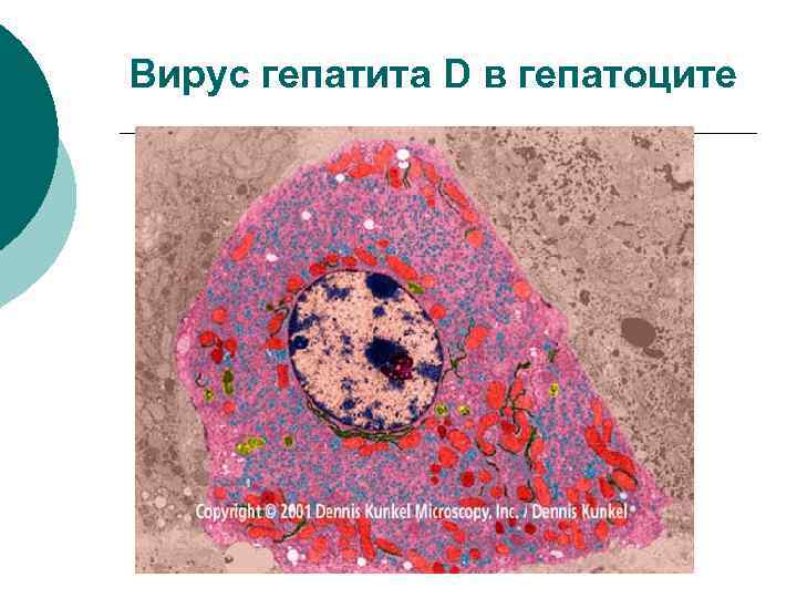 Вирус гепатита D в гепатоците 