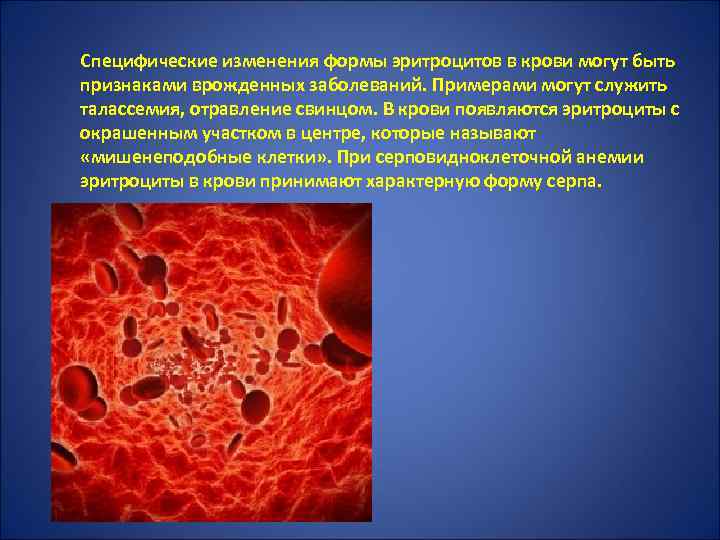 Специфические изменения формы эритроцитов в крови могут быть признаками врожденных заболеваний. Примерами могут служить