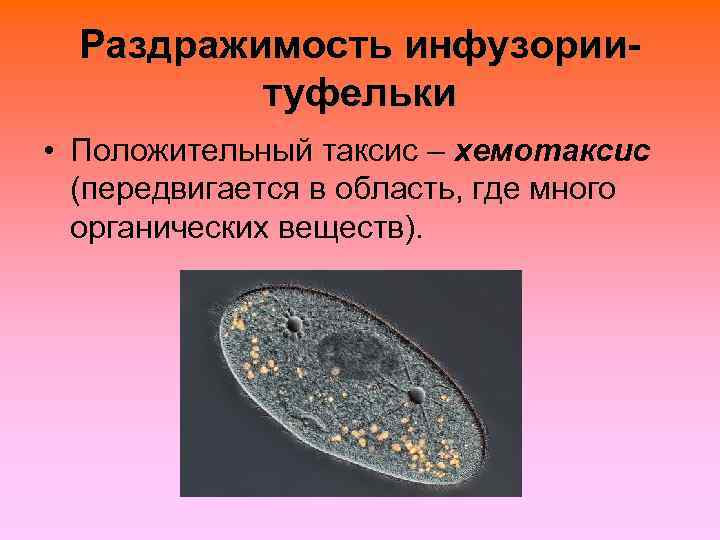 Какой тип питания характерен для инфузории туфельки изображенной на рисунке