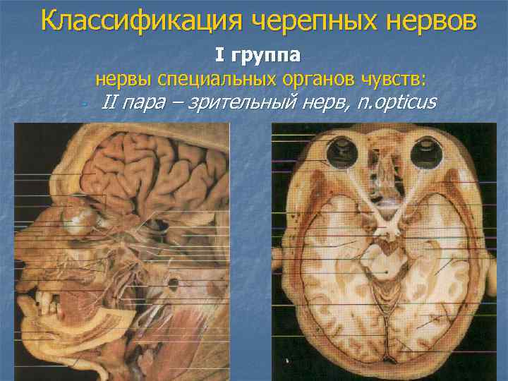 Классификация черепных нервов I группа нервы специальных органов чувств: - II пара – зрительный