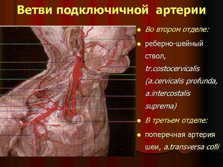 Ветви подключичной артерии l Во втором отделе: l реберно-шейный ствол, tr. costocervicalis (a. cervicalis