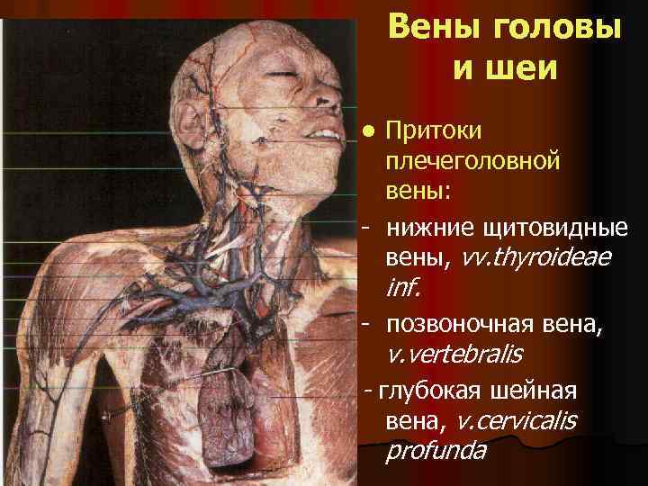 Вены головы и шеи Притоки плечеголовной вены: - нижние щитовидные вены, vv. thyroideae l