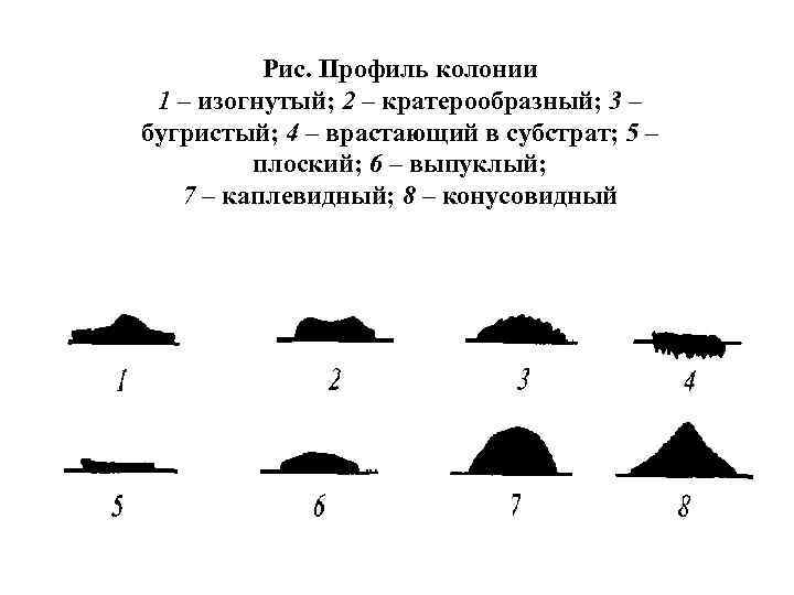 Рис. Профиль колонии 1 – изогнутый; 2 – кратерообразный; 3 – бугристый; 4 –