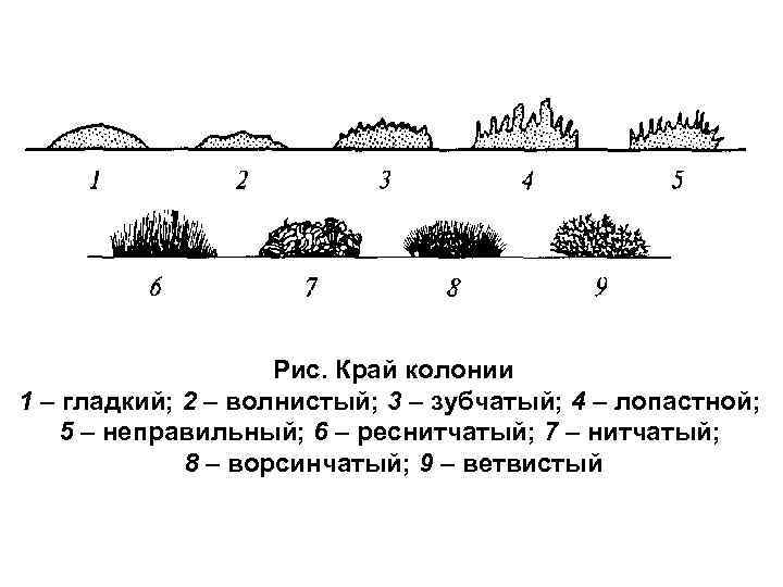 Рис. Край колонии 1 – гладкий; 2 – волнистый; 3 – зубчатый; 4 –