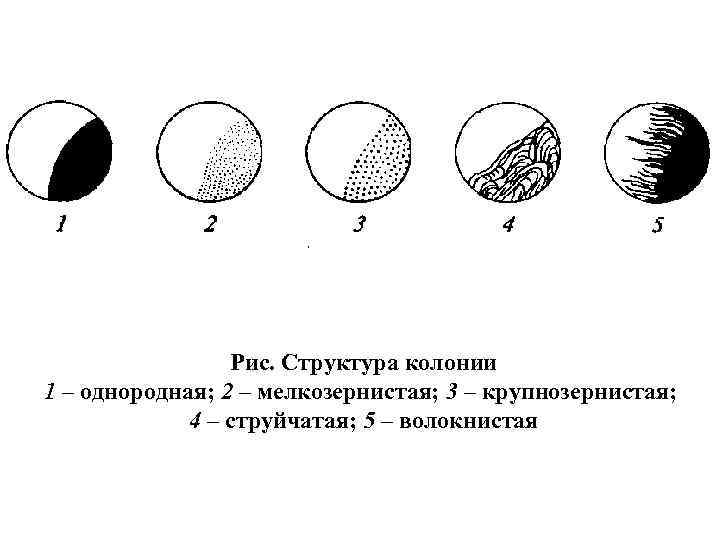 Рис. Структура колонии 1 – однородная; 2 – мелкозернистая; 3 – крупнозернистая; 4 –
