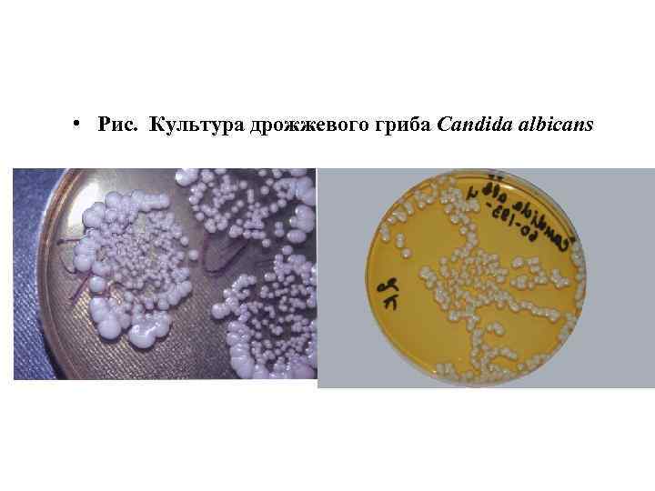  • Рис. Культура дрожжевого гриба Candida albicans 