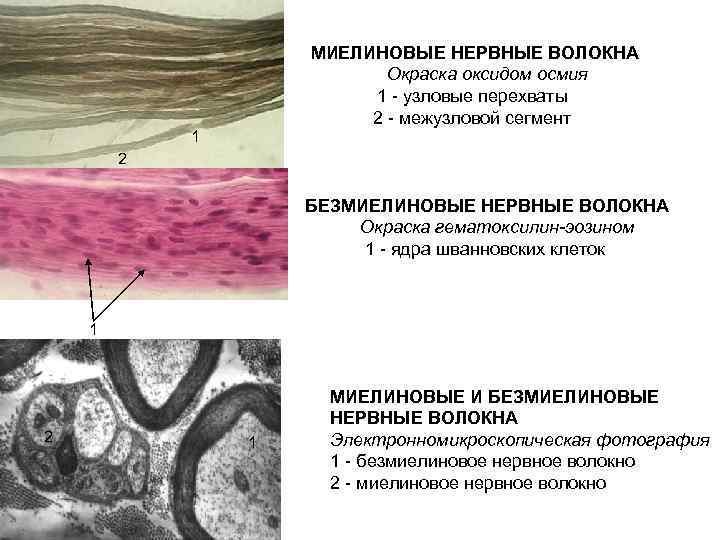 МИЕЛИНОВЫЕ НЕРВНЫЕ ВОЛОКНА Окраска оксидом осмия 1 - узловые перехваты 2 - межузловой сегмент