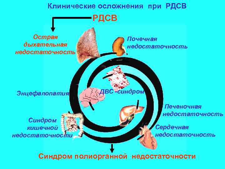 Клинические осложнения при РДСВ Острая дыхательная недостаточность Энцефалопатия Синдром кишечной недостаточности Почечная недостаточность ДВС