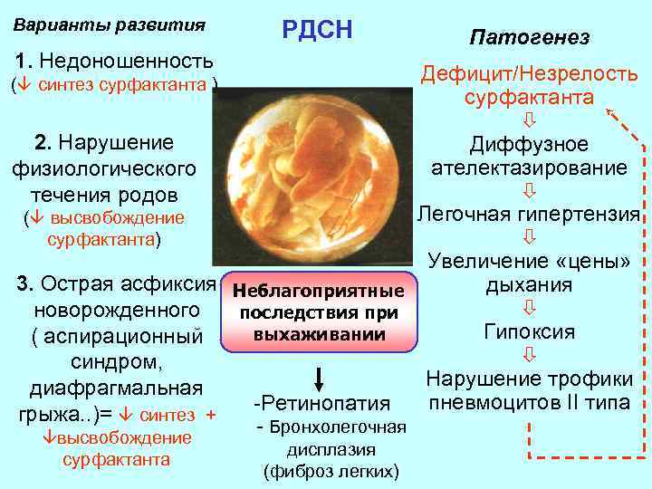 Варианты развития РДСН 1. Недоношенность Патогенез Дефицит/Незрелость сурфактанта 2. Нарушение Диффузное ателектазирование физиологического течения