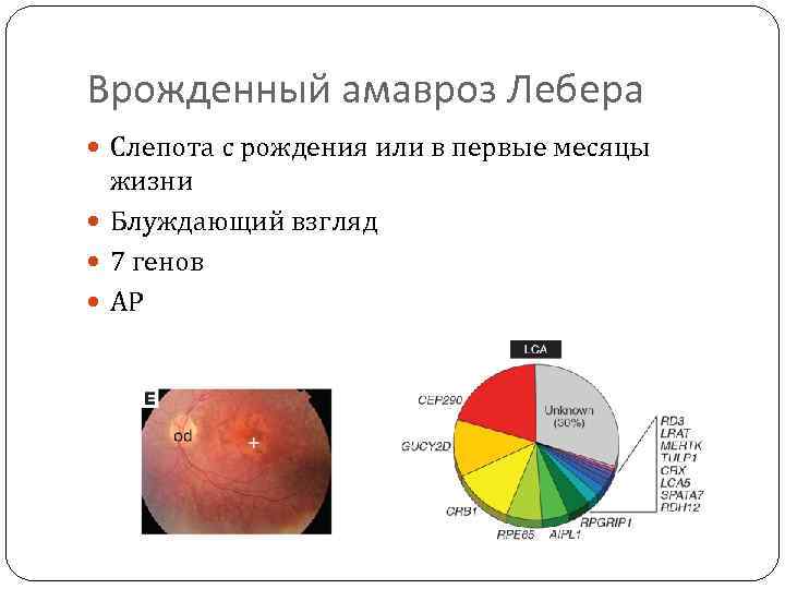 Врожденный амавроз Лебера Слепота с рождения или в первые месяцы жизни Блуждающий взгляд 7