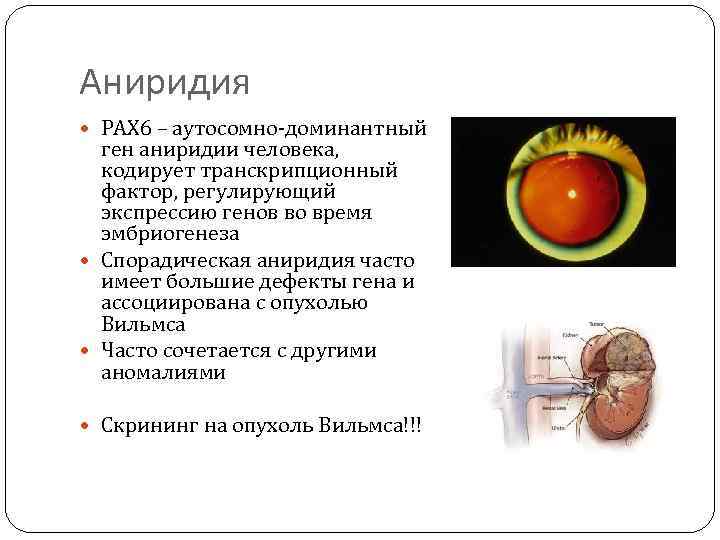 Аниридия РАХ 6 – аутосомно-доминантный ген аниридии человека, кодирует транскрипционный фактор, регулирующий экспрессию генов