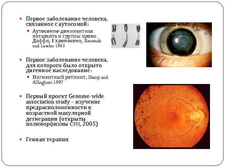  Первое заболевание человека, связанное с аутосомой: Аутосомно-доминантная катаракта и группы крови Даффи, 1