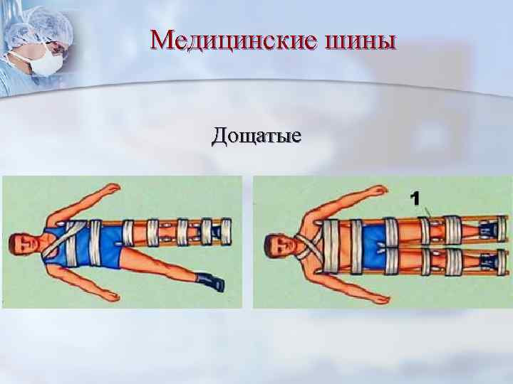 Медицинские шины Дощатые 
