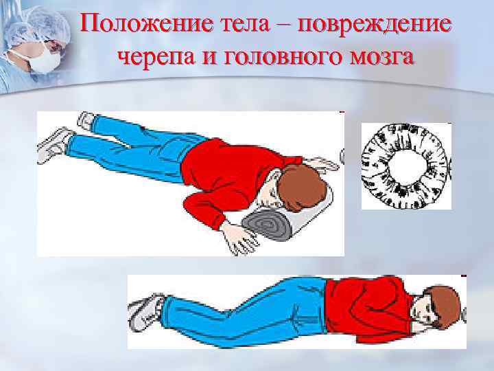 Положение тела – повреждение черепа и головного мозга 
