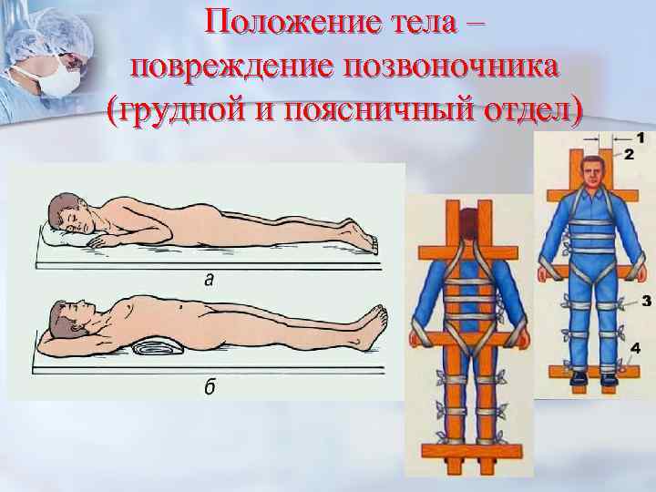 Положение тела – повреждение позвоночника (грудной и поясничный отдел) 