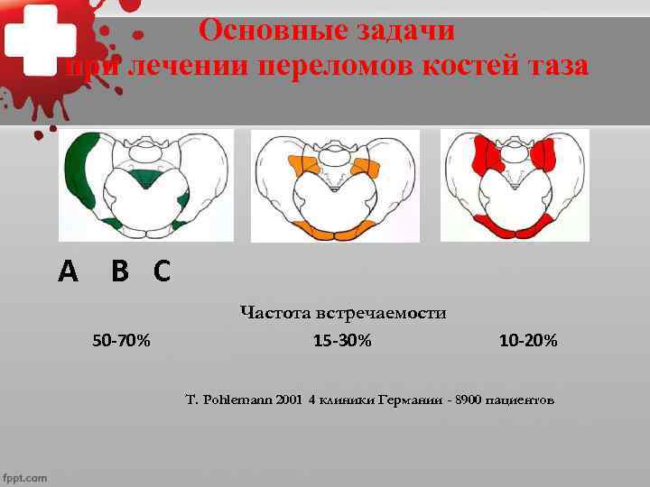 Основные задачи при лечении переломов костей таза A B C 50 -70% Частота встречаемости