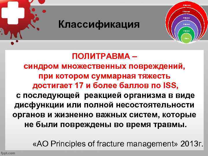 6 баллов 5 баллов Классификация 4 балла 3 балла 2 балла 1 балл ПОЛИТРАВМА