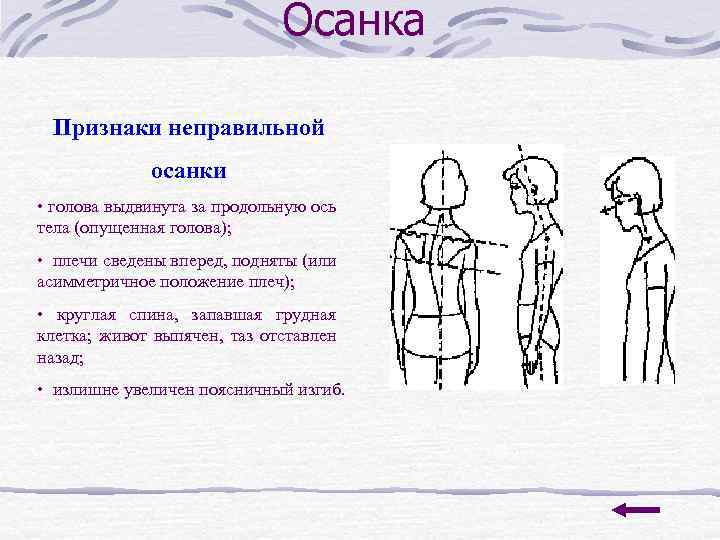 Осанка Признаки неправильной осанки • голова выдвинута за продольную ось тела (опущенная голова); •