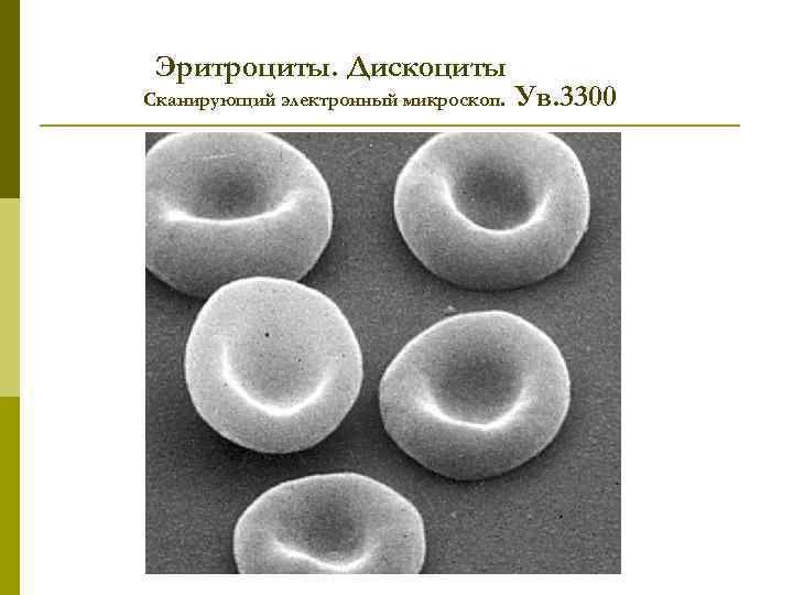 Эритроциты. Дискоциты Сканирующий электронный микроскоп. Ув. 3300 