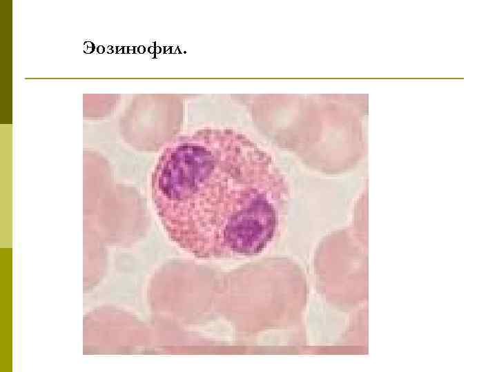 Эозинофил. 