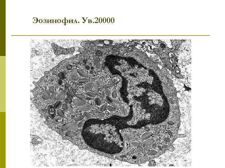Эозинофил. Ув. 20000 