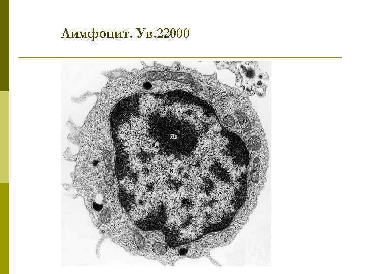 Лимфоцит. Ув. 22000 