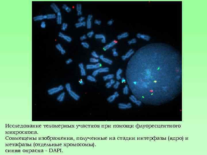 Исследование теломерных участков при помощи флуоресцентного микроскопа. Совмещены изображения, полученные на стадии интерфазы (ядро)