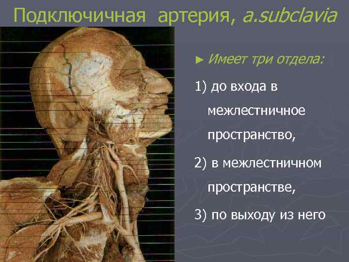 Подключичная артерия, a. subclavia ► Имеет три отдела: 1) до входа в межлестничное пространство,