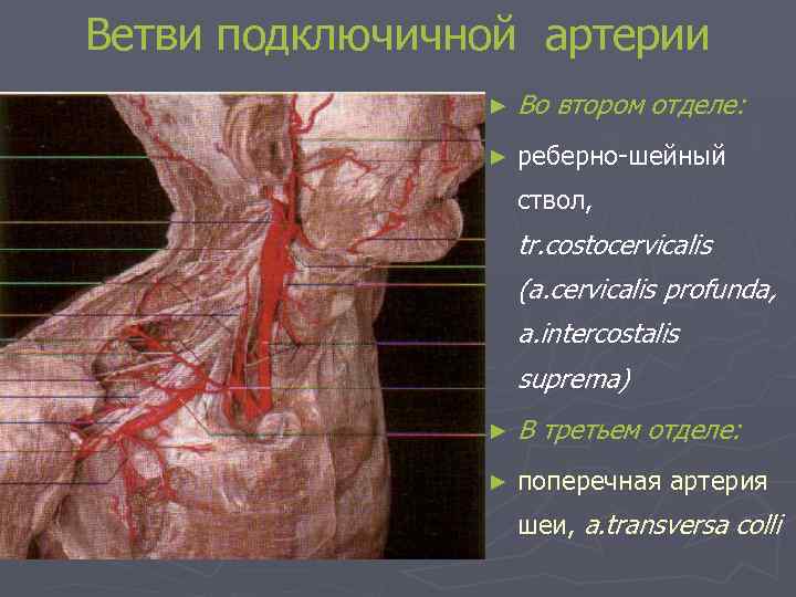 Ветви подключичной артерии ► Во втором отделе: ► реберно-шейный ствол, tr. costocervicalis (a. cervicalis