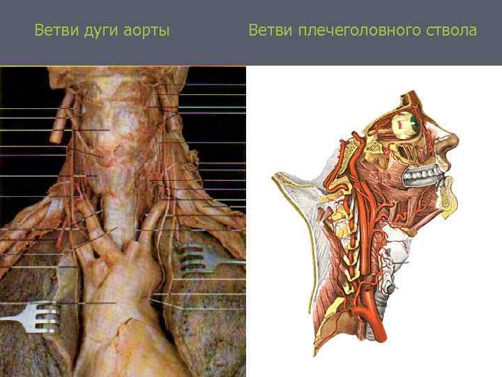 Ветви дуги аорты Ветви плечеголовного ствола 