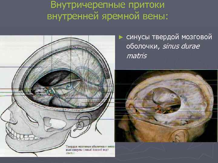 Внутричерепные притоки внутренней яремной вены: ► cинусы твердой мозговой оболочки, sinus durae matris 