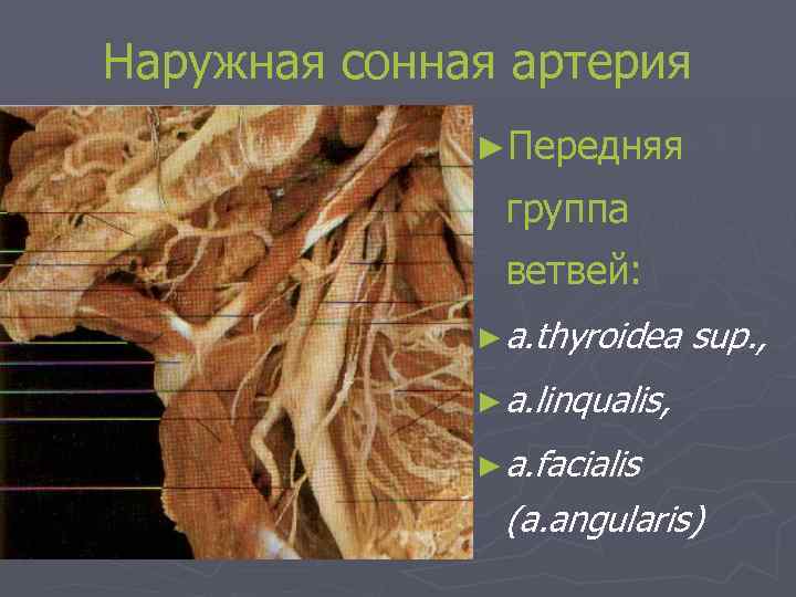 Наружная сонная артерия ►Передняя группа ветвей: ► a. thyroidea sup. , ► a. linqualis,