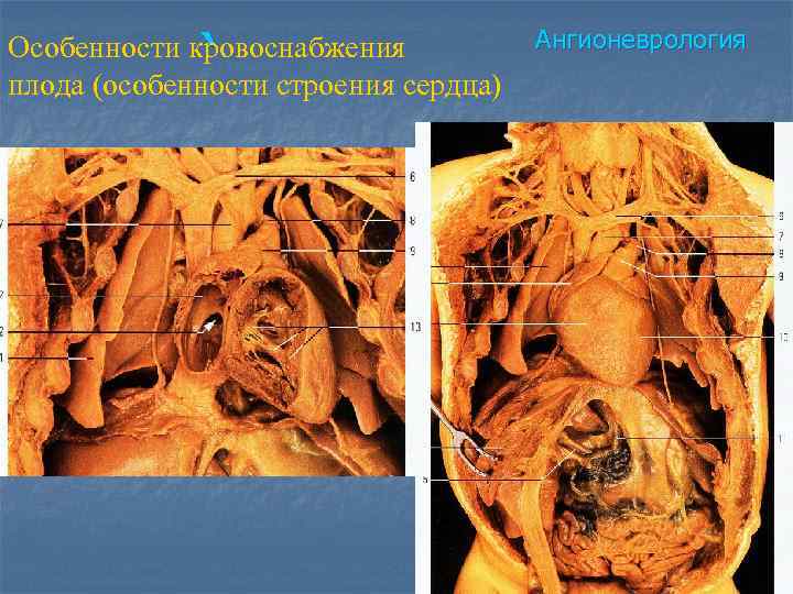 ` Особенности кровоснабжения плода (особенности строения сердца) Ангионеврология 