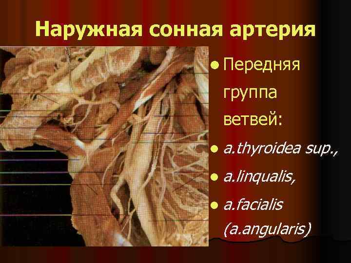 Наружная сонная артерия l Передняя группа ветвей: l a. thyroidea sup. , l a.