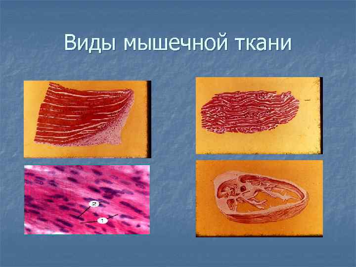 Виды мышечной ткани 