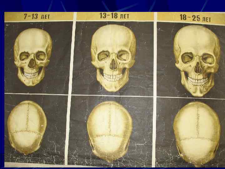 Меняется форма черепа. Череп ребёнка и взрослого человека. Формирование черепа у младенца. Череп человека в разном возрасте.
