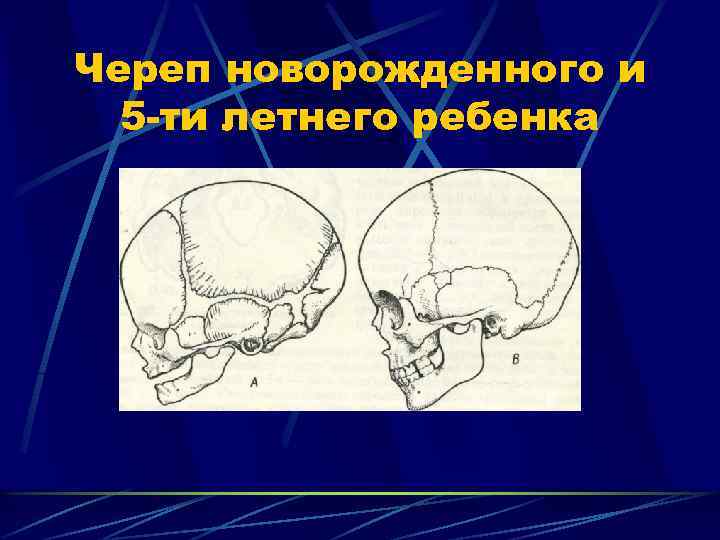 Череп новорожденного и 5 -ти летнего ребенка 